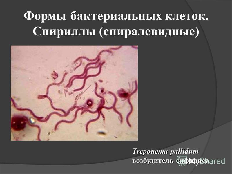 Формы бактериальных клеток. Спириллы (спиралевидные) Treponema pallidum возбудитель сифилиса