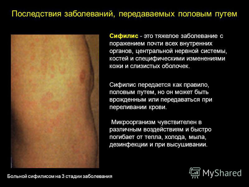 Тошнит болит низ живота и выделения после месячных