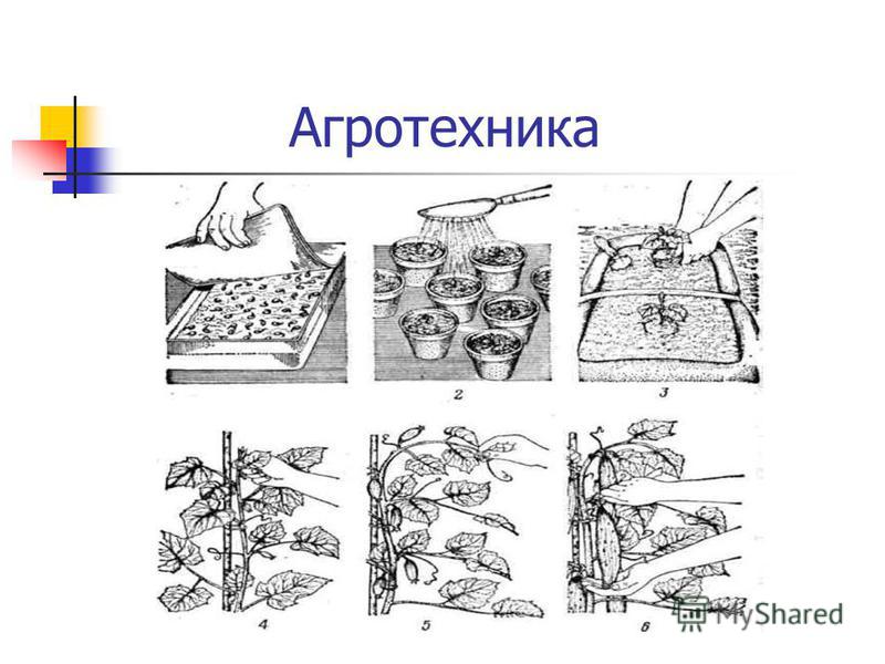 Все льготы при сахарном диабете 1 типа