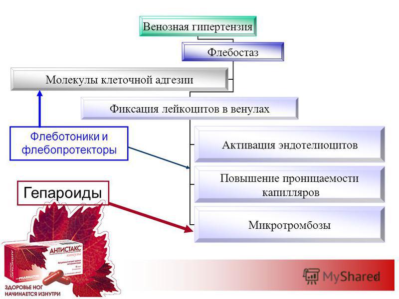 Операция тромбофлебит киев