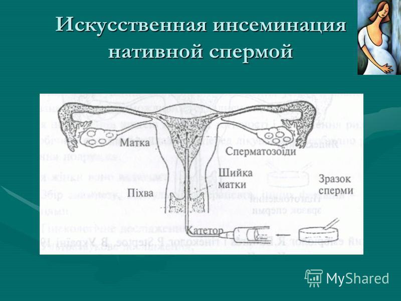Искусственная инсеминация в домашних условиях