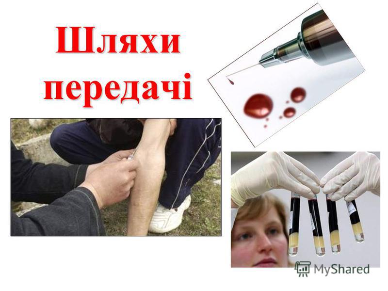 Признаки причины желтухи
