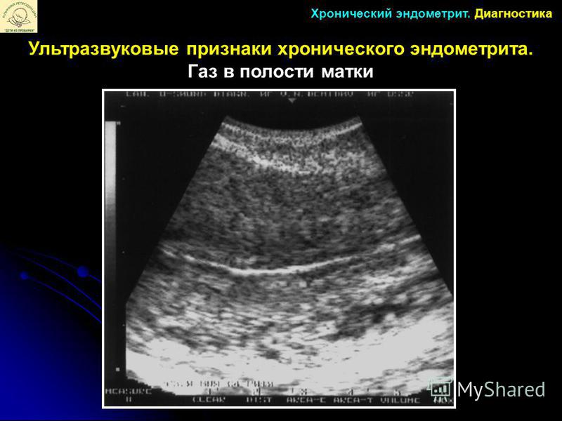 5 поводов для обращения к детскому гинекологу - Полезная Эндометрит и беременность!