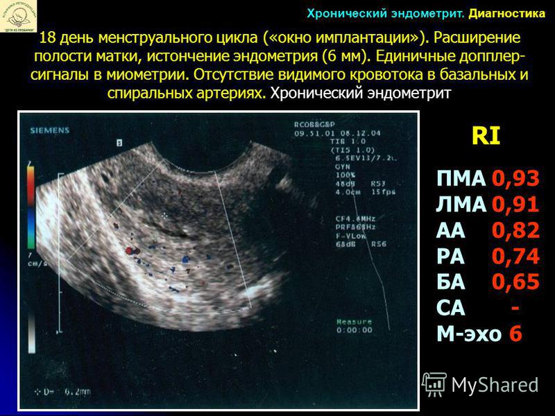 окно имплантации узи окно имплантации узи