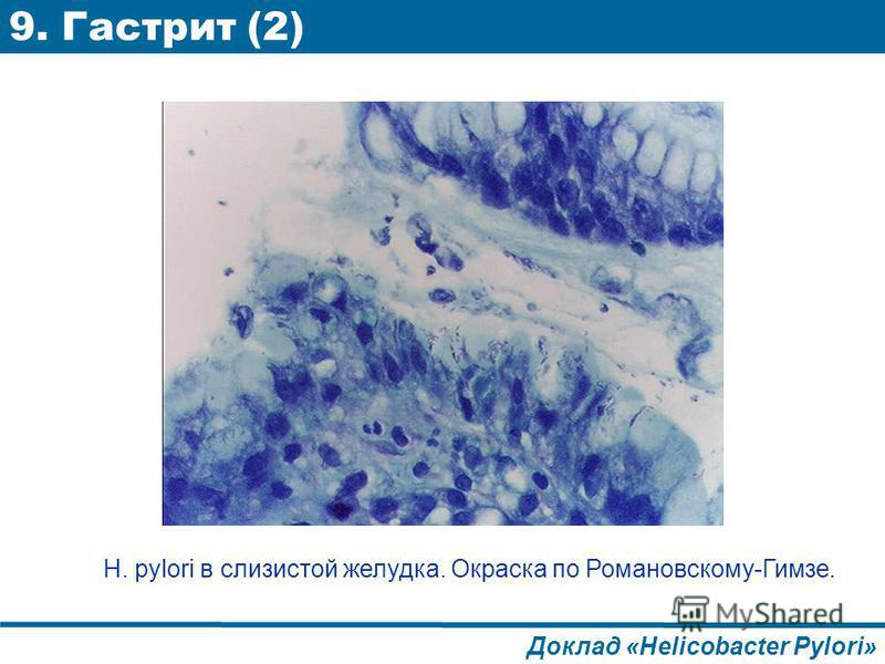 Лекарства от боли в горле кашле и насморке