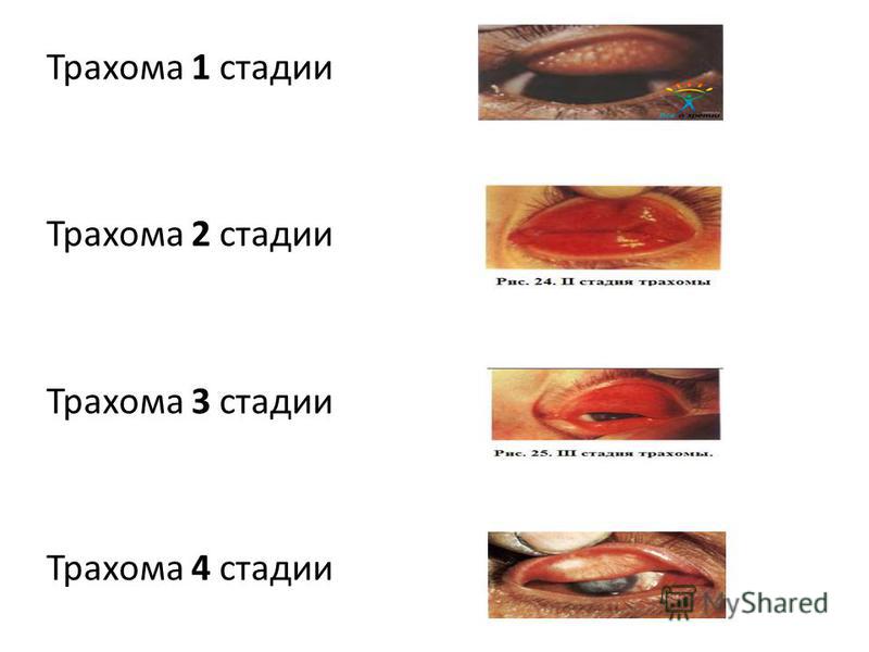 Русское порно старых - видео / top @ Her Flesh HD