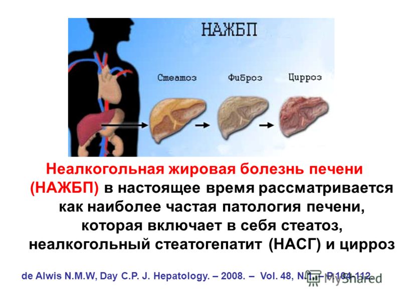 Тянущая боль слева у мужчин