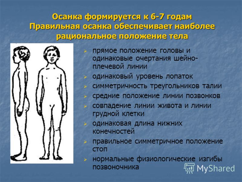 Формирование физиологических изгибов позвоночника у детей Формирование физиологических изгибов позвоночника у детей
