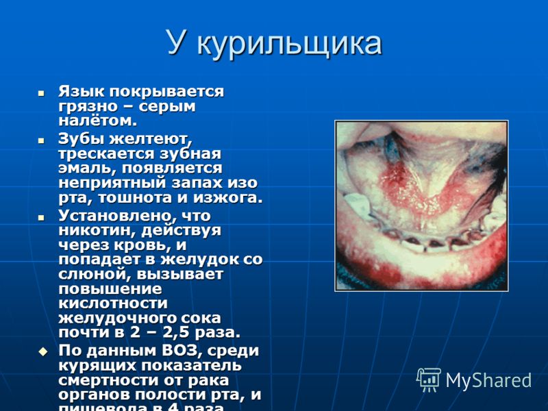 запах мокроты изо рта запах мокроты изо рта