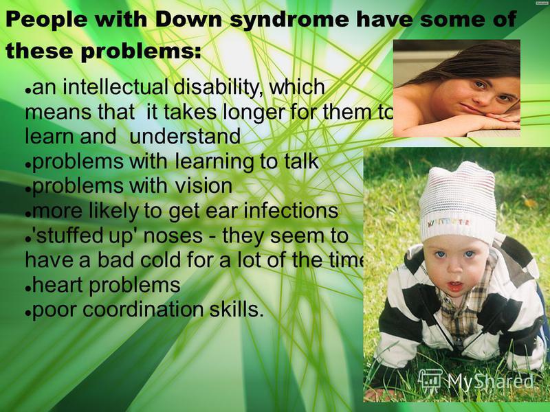 Vision Problems in People with Down Syndrome - Down TV: Portal de vídeos  sobre síndrome de down Down TV: Portal de vídeos sobre síndrome de down