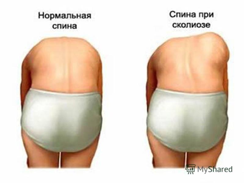 сиди за партой правильно картинки сиди за партой правильно картинки