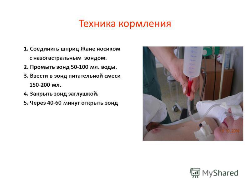 Введение и уход за назогастральным зондом Введение и уход за назогастральным зондом