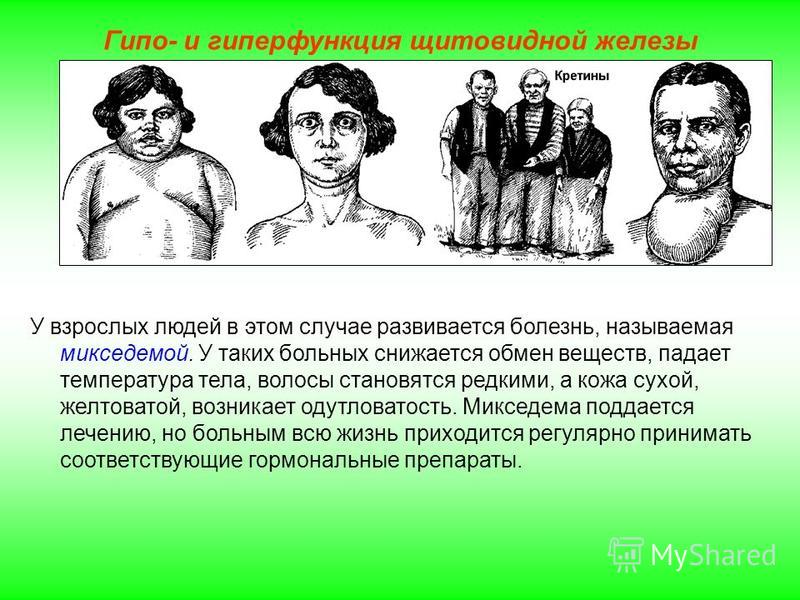 Детские заболевания глаз из книги: Справочник - детские болезни Детские заболевания глаз из книги: Справочник - детские болезни