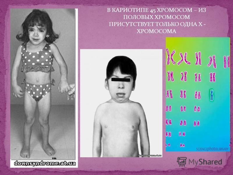 Комплекс лфк при боли в пояснице
