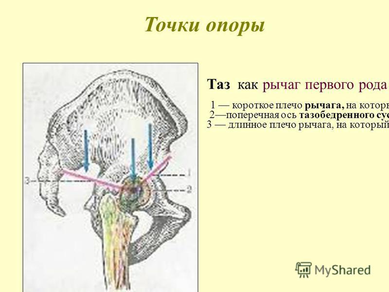 Окостенение тазобедренного сустава у новорожденного Окостенение тазобедренного сустава у новорожденного
