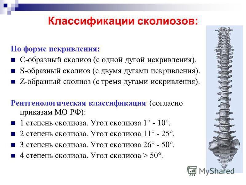 Как исправит искривленный позвоночник Как исправит искривленный позвоночник
