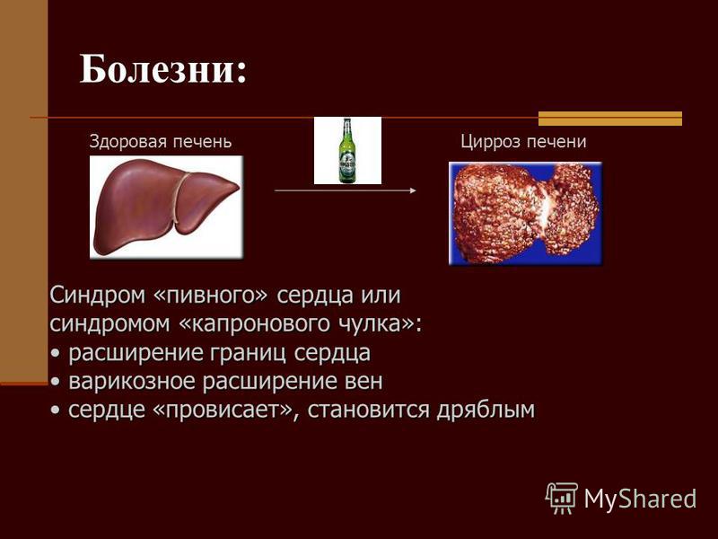 Вред от чистки печени в домашних условиях Вред от чистки печени в домашних условиях