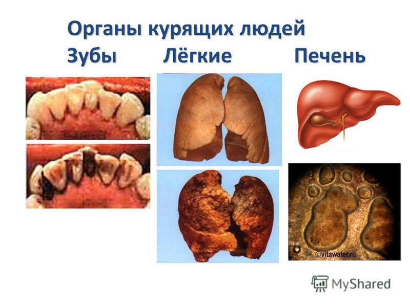 Органы курящих людей Зубы Лёгкие Печень