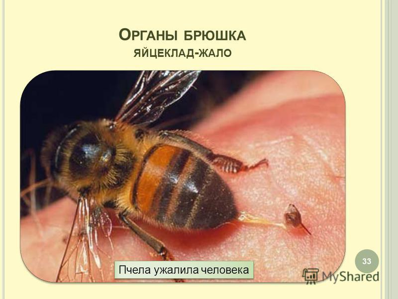 О РГАНЫ БРЮШКА ЯЙЦЕКЛАД - ЖАЛО 33 Пчела ужалила человека
