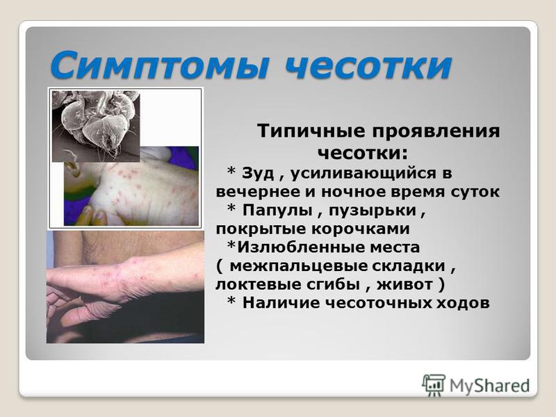 педикулёз симптомы фото педикулёз симптомы фото