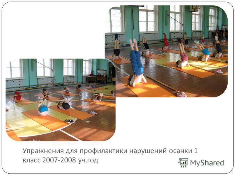 Начальная степень сколиоза