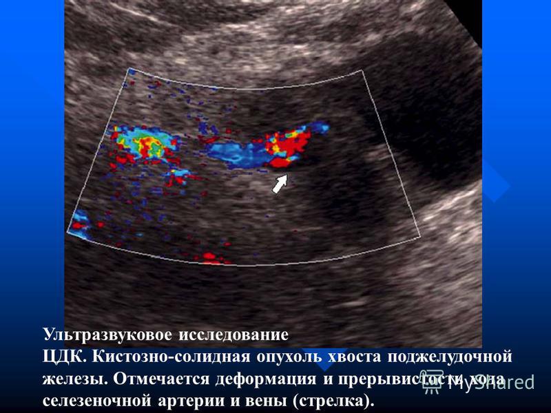 НОВЫЕ МЕТОДЫ ЛЕЧЕНИЯ ПРОСТАТИТА И все Молот тора капли для потенции купить в аптеке в ульяновске - Акции