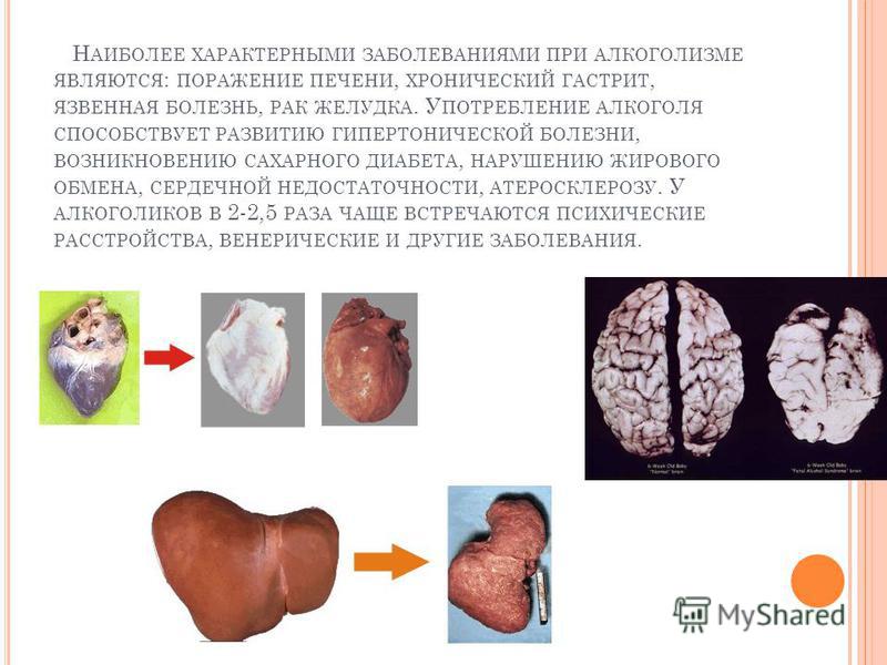Макаревич: жизнь не по лжи - Старый солдат - zergulio МЕНТАЛЬНЫЕ ПРИЧИНЫ РАЗЛИЧНЫХ