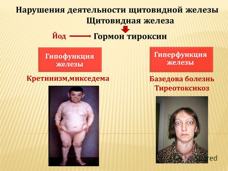 Как лечить недостаток гормона щитовидной железы Как лечить недостаток гормона щитовидной железы