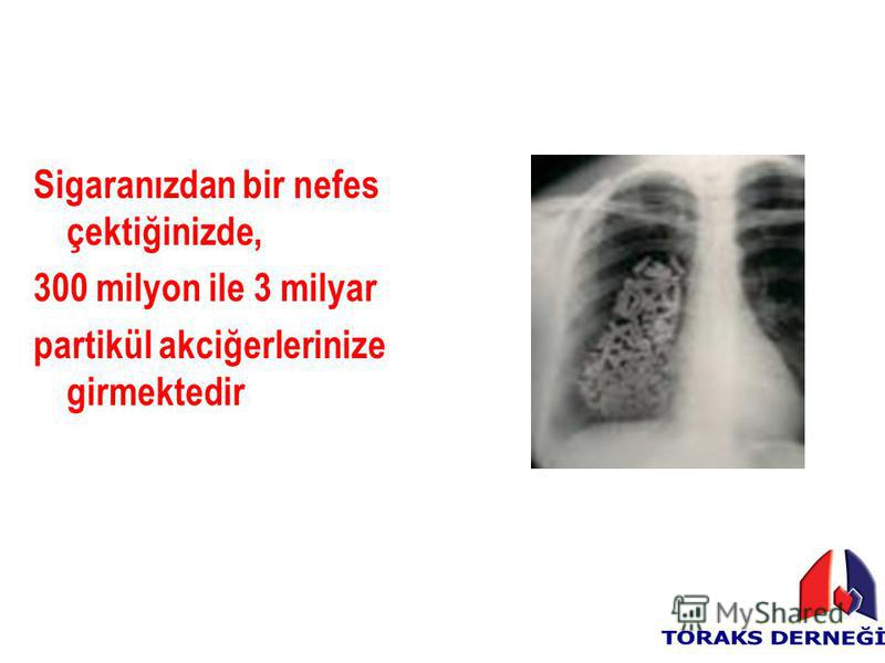 Sigaranızdan bir nefes çektiğinizde, 300 milyon ile 3 milyar partikül akciğerlerinize girmektedir
