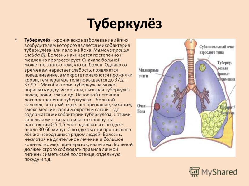 Туберкулёз Туберкулёз – хроническое заболевание лёгких, возбудителем которого является микобактерия туберкулёза или палочка Коха. (демонстрация слайда