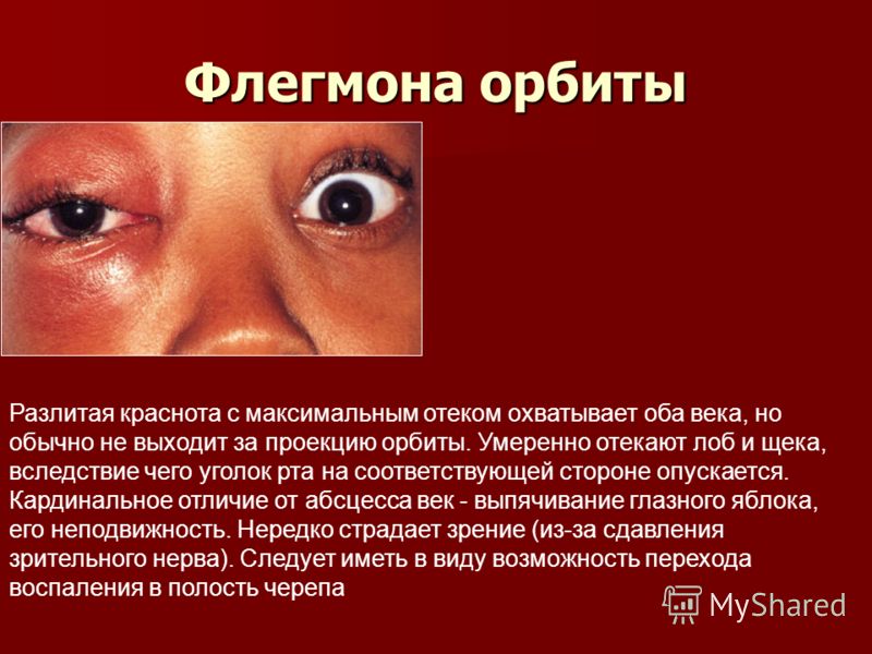 Вернуть зрение гимнастикой для глаз