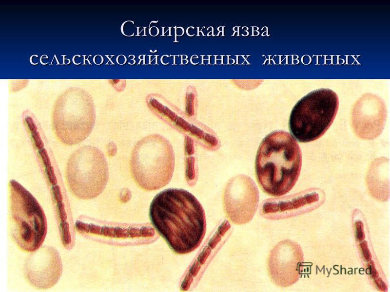 Реферат: Сибирская язва этиология и лечение