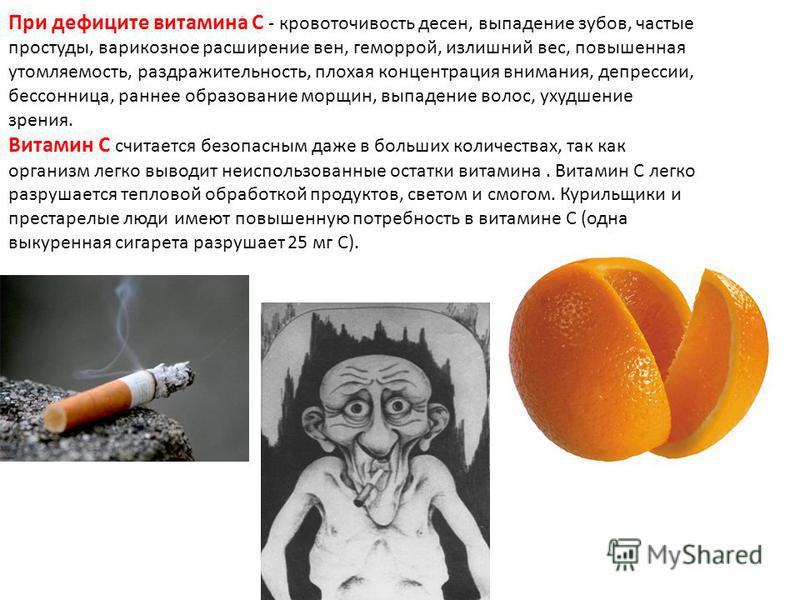 Каких витамин не хватает при кровоточивости десен Каких витамин не хватает при кровоточивости десен