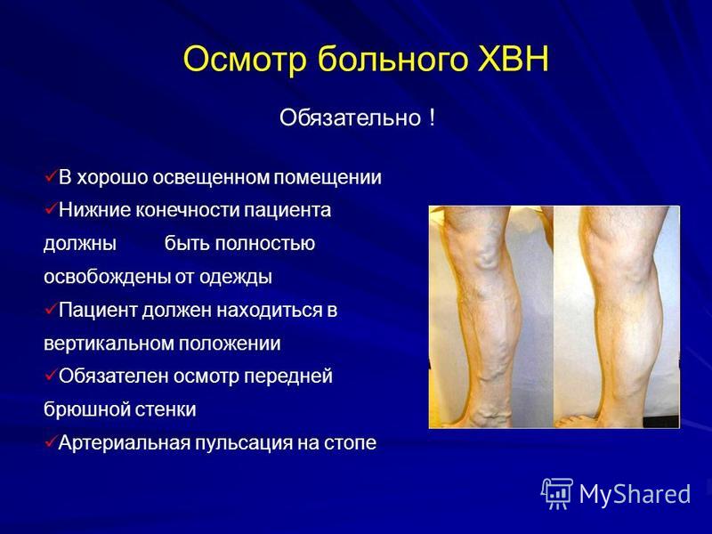 Хроническая венозная недостаточность как лечить Хроническая венозная недостаточность как лечить