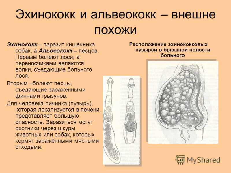 какие виды паразитов бывают у человека какие виды паразитов бывают у человека
