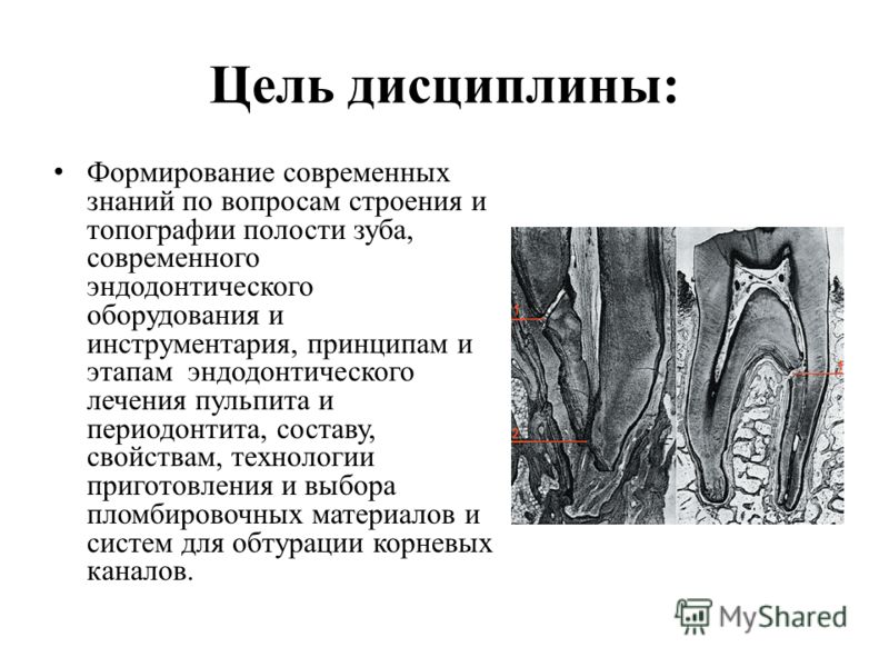 Цель дисциплины: Формирование современных знаний по вопросам строения и топографии полости зуба, современного эндодонтического оборудования и инструме