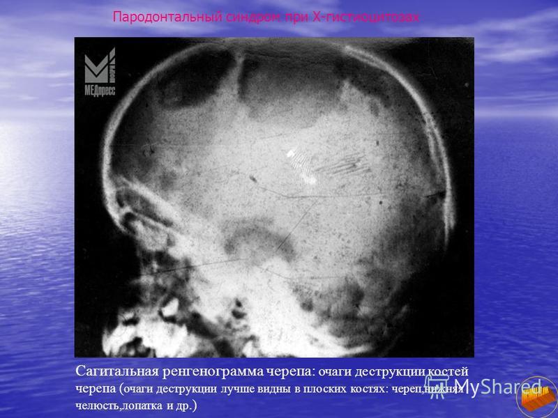 у подростка запах изо рта причины у подростка запах изо рта причины
