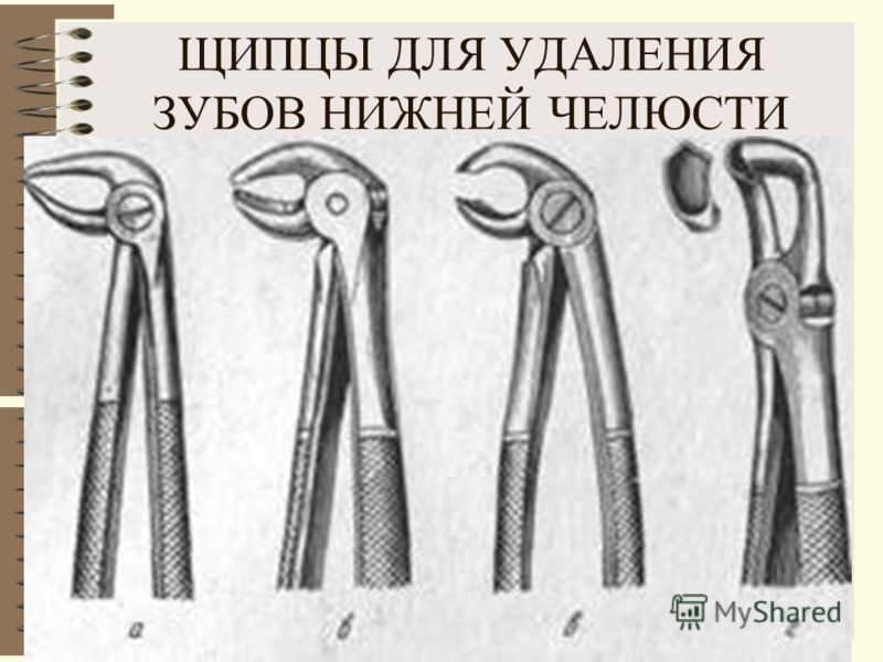 Лунки после удаления зубов у детей Лунки после удаления зубов у детей