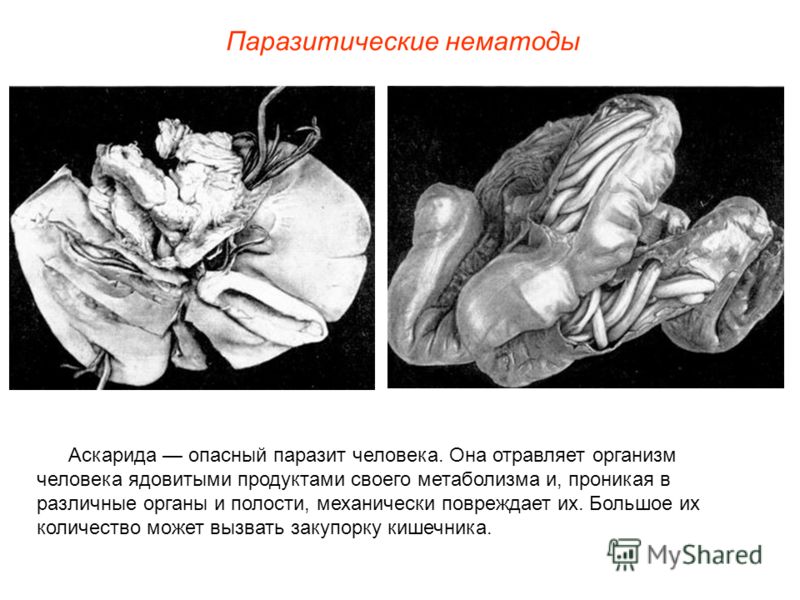 черви в коже человека болезнь черви в коже человека болезнь