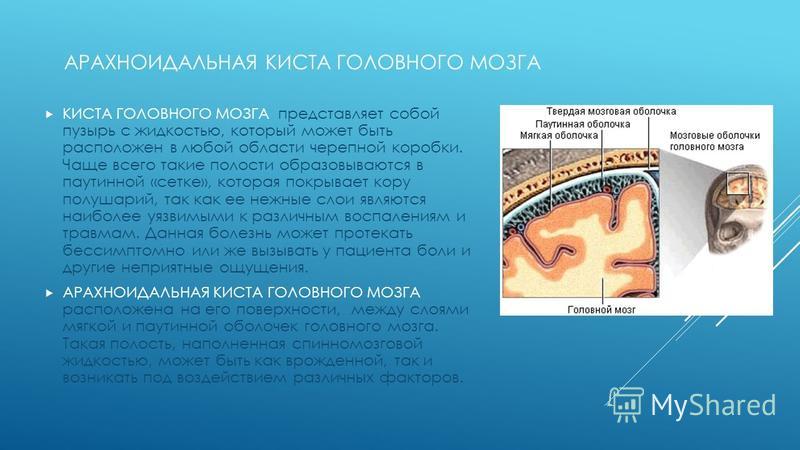 Ретроцеребеллярная арахноидальная киста как лечить Ретроцеребеллярная арахноидальная киста как лечить