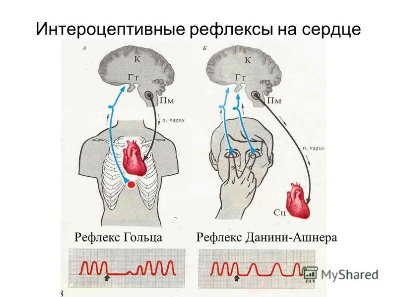 рефлекс през-в 3 классик рефлекс през-в 3 классик