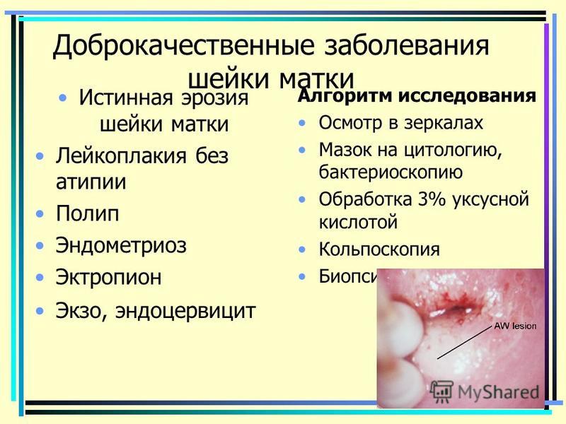 Как лечить воспаление шейки матки антибиотики 9