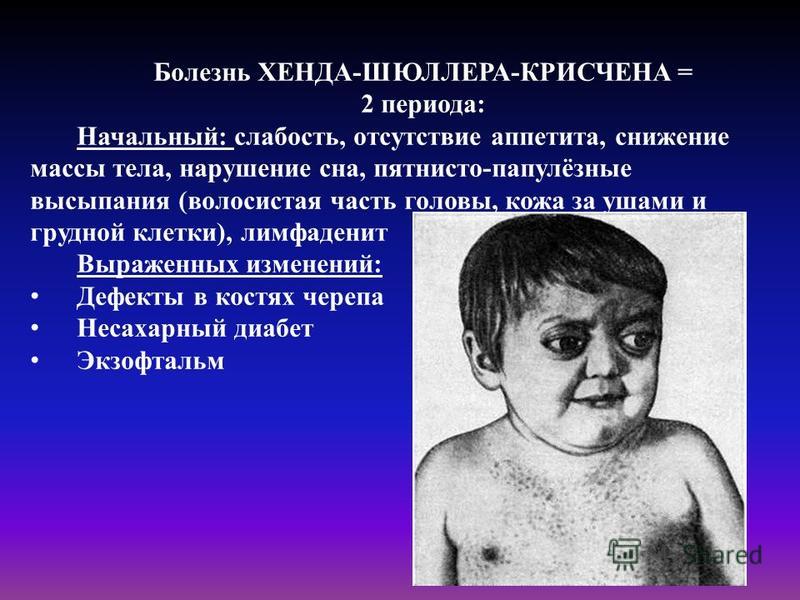 Болезнь зубов у детей 2 лет Болезнь зубов у детей 2 лет