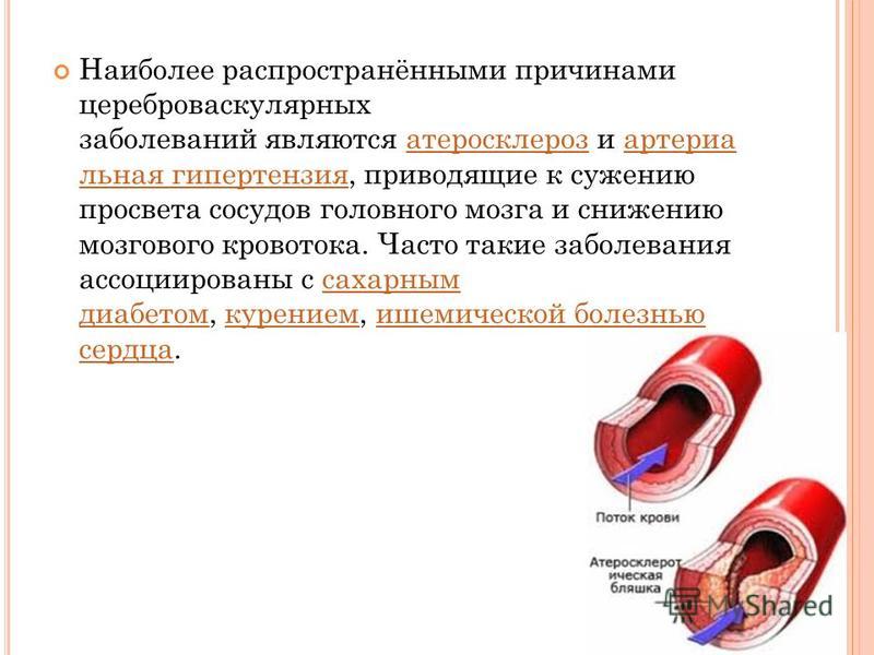 Снижать уровень холестерина