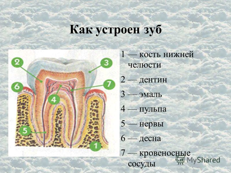 Почему в зубах образуются дырки Почему в зубах образуются дырки
