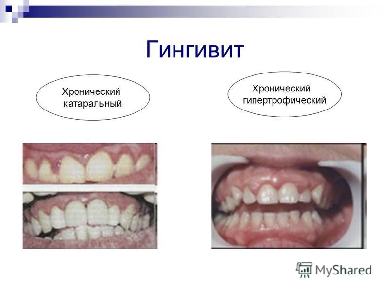 Как убрать шрамы от прыщей и избавиться от них: маски, кремы Как сделать красивую прическу самой себе: 18 причесок