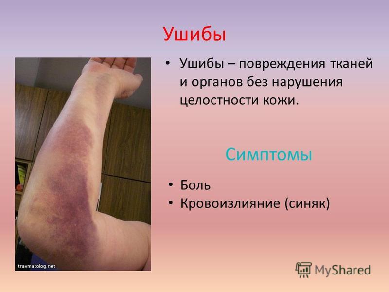 Как лечить переломы ушибы народными средствами Как лечить переломы ушибы народными средствами