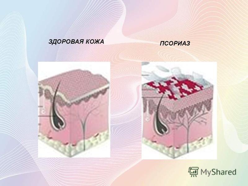 Делится клетка на коже Делится клетка на коже