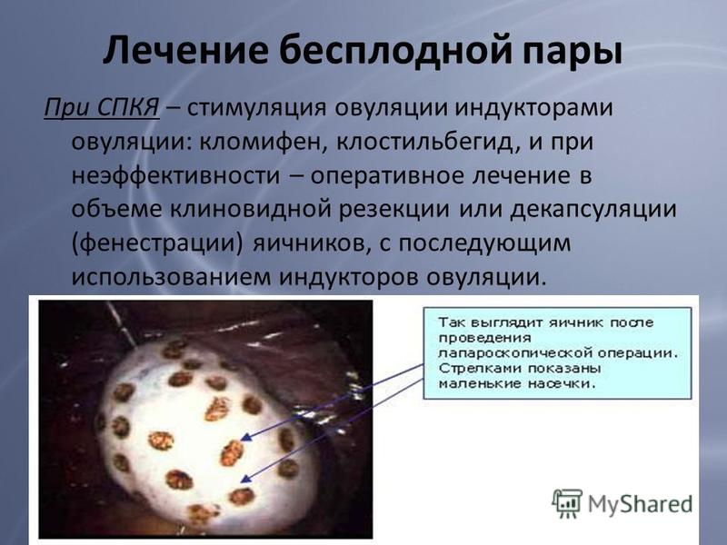 Можно Ли Заниматься Сексом При Стимуляции Яичников