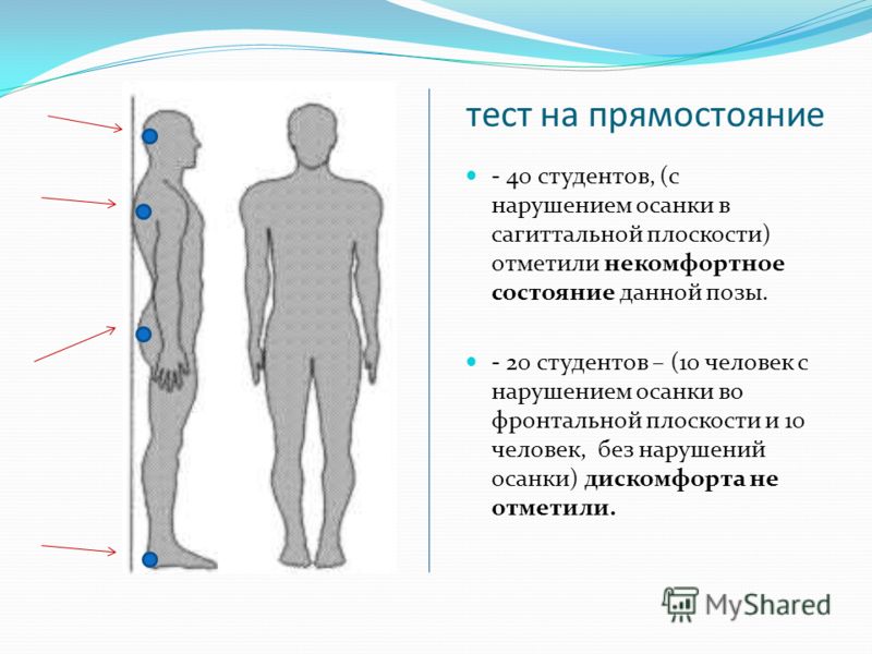 Тест адамса при сколиозе